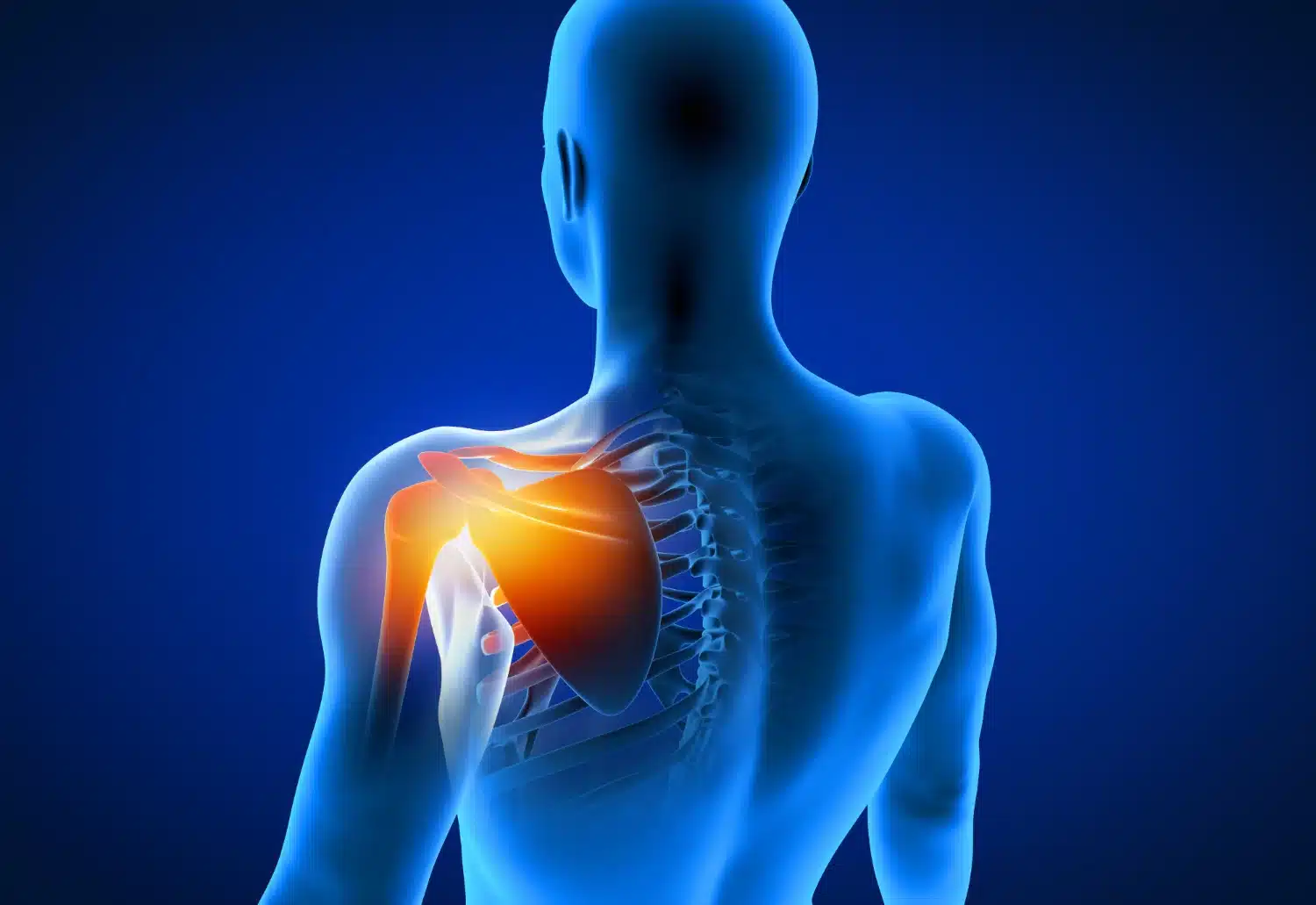frozen shoulder inflammation around the shoulder joint