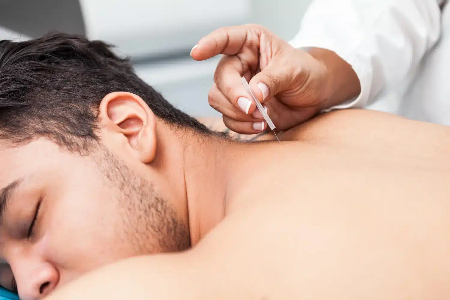What is acupuncture?