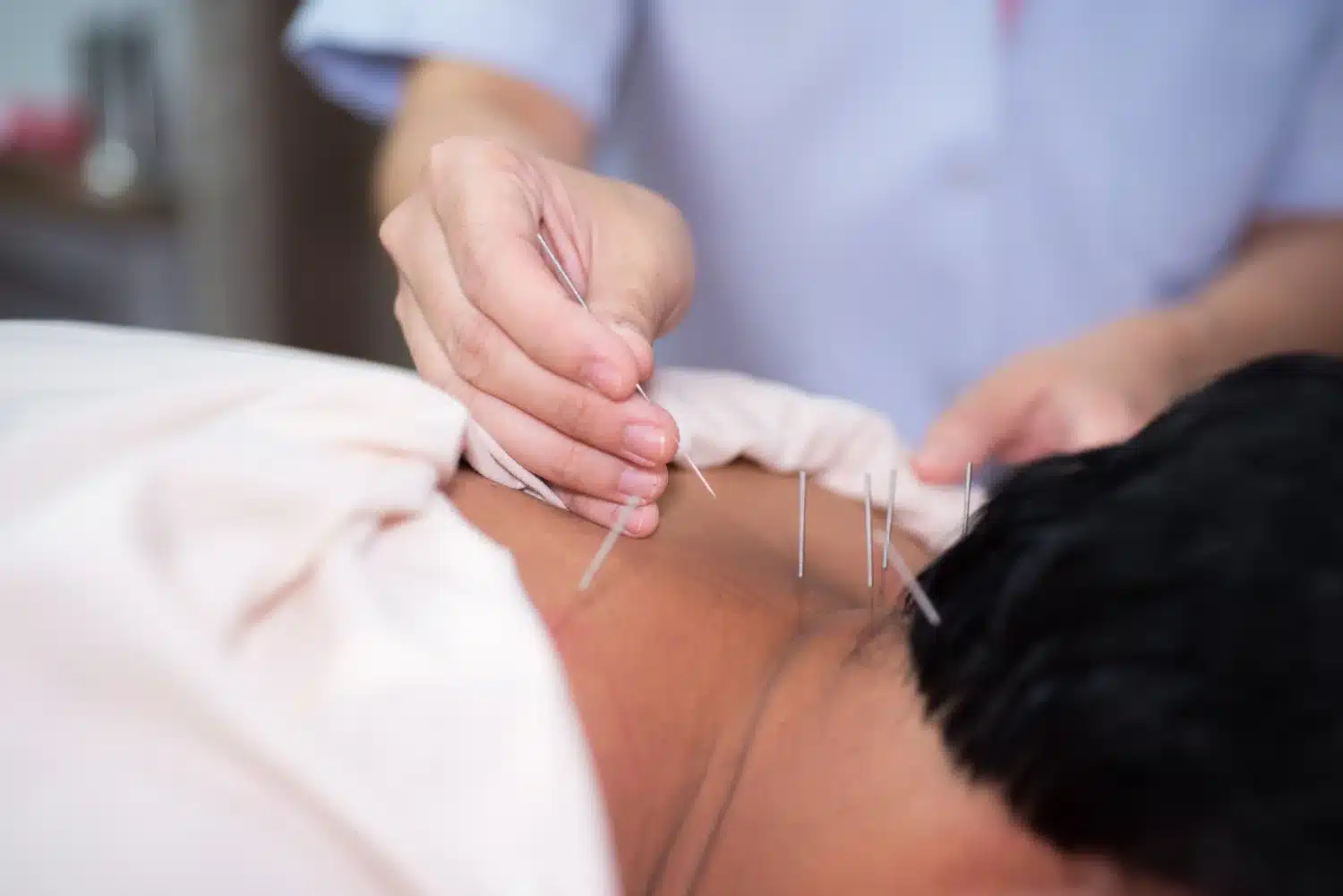 Featured image for “Acupuncture vs Dry Needling Myths Explained”